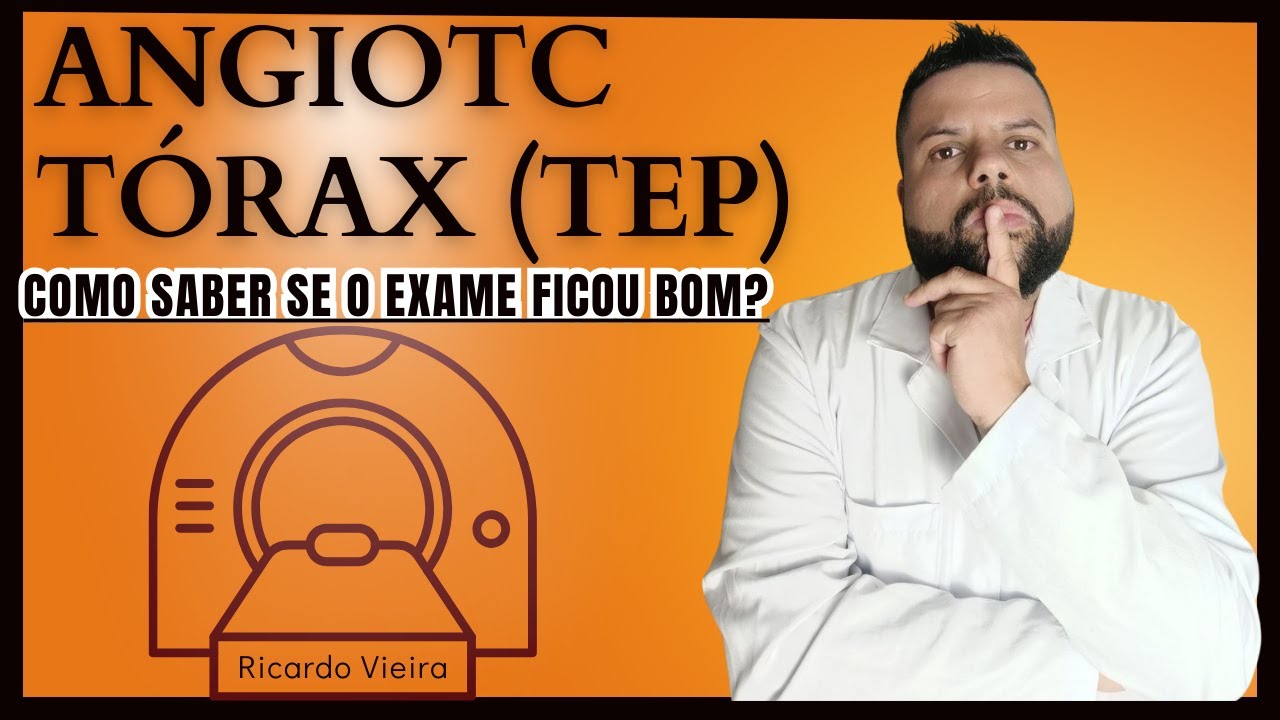 ANGIO-TC TÓRAX(TEP): Identificando ERROS E ACERTOS!