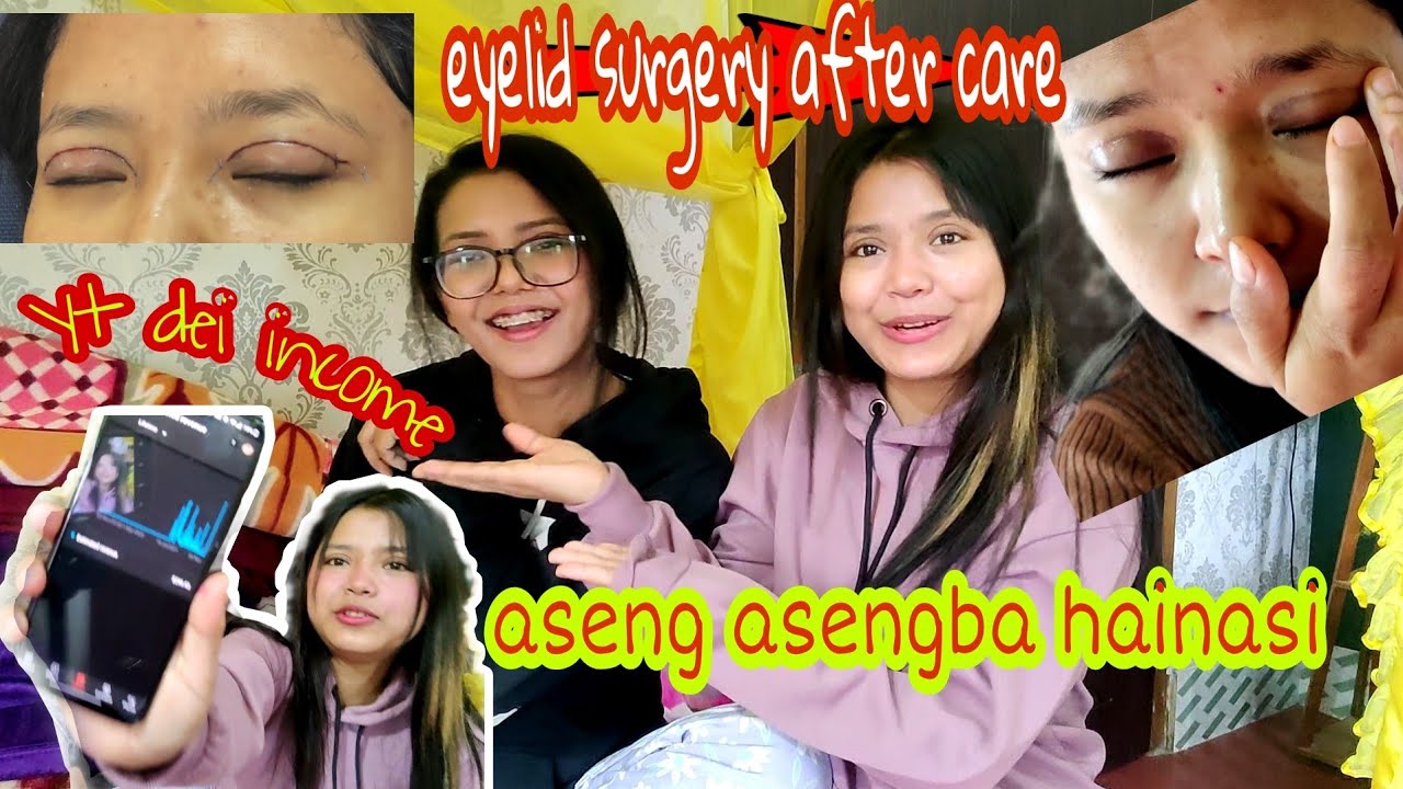 Eyelid surgery Cost & after care anti scar products || best reviewed Products from Amazon