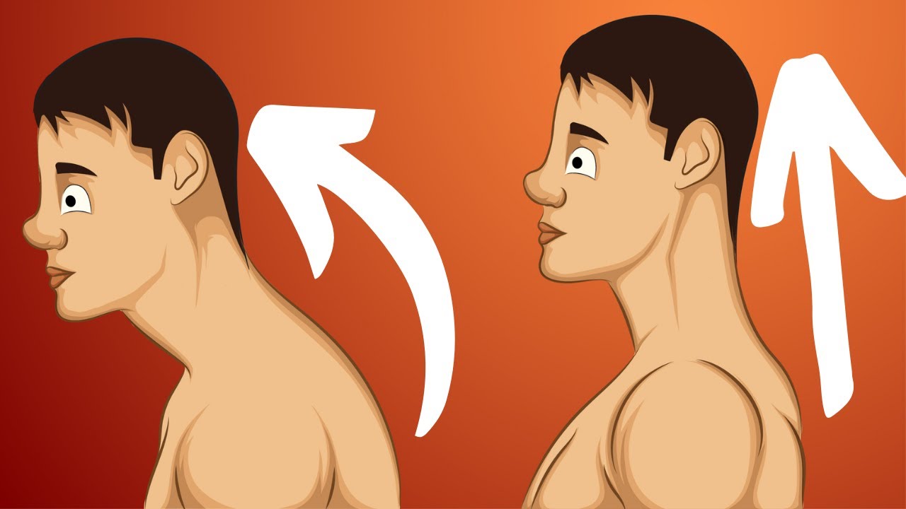 Comment corriger sa posture ? (Voici ce que tu dois faire)