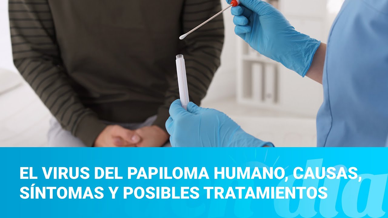 El virus del papiloma humano, causas, síntomas y posibles tratamientos