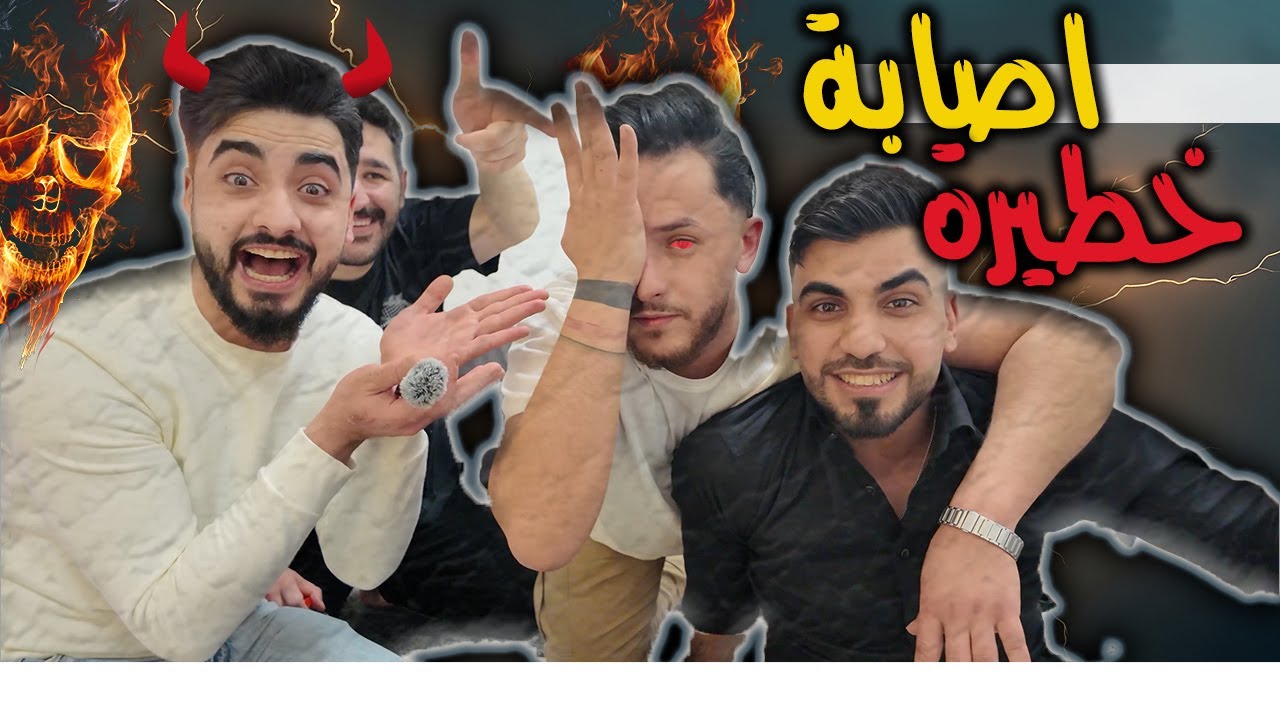 عبدالله غازي - عملنا تحدي - وتعرضنا لأصابة خطيرة😐🤕