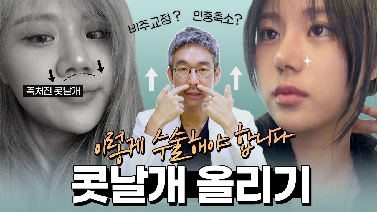 축처진 콧날개, 콧날개올리기의 올바른 수술법은? (feat.비주교정, 콧볼축소, 인중축소, 비익거상)