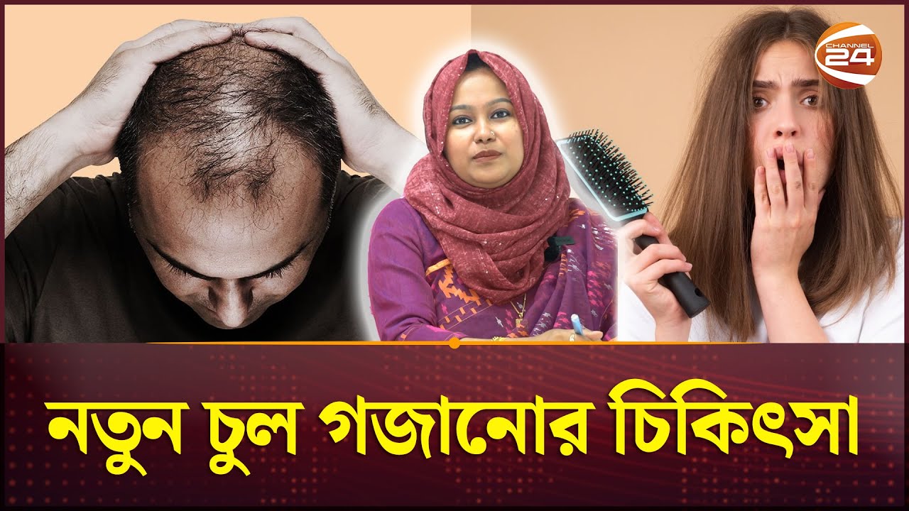 নতুন চুল গজানোর চিকিৎসা পদ্ধতি  | Hair Grow Up Treatment | Channel 24