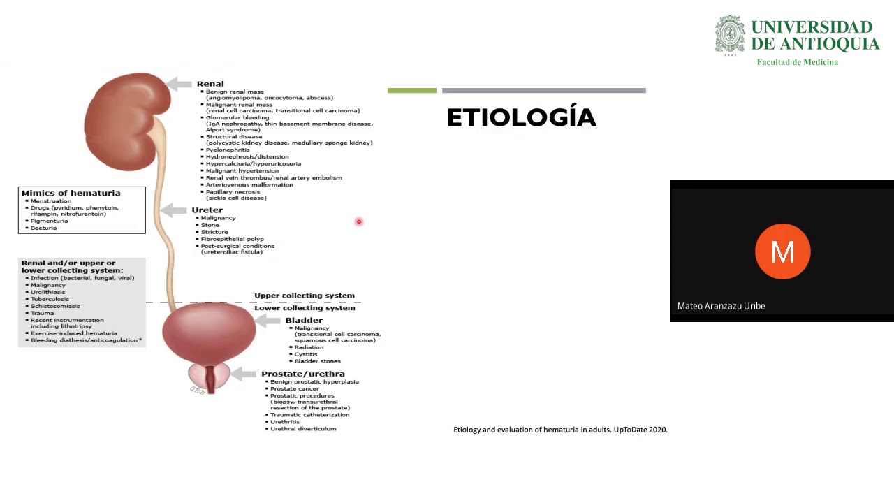 Enfoque del Paciente con Hematuria - Dr. Mateo Aranzazu
