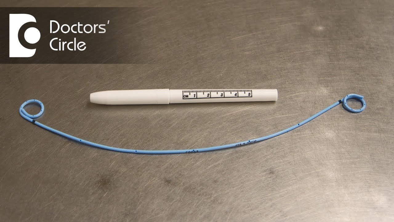 What is a Ureteral Stent How is a Stent placed & removed?- Dr. Santosh Bethur