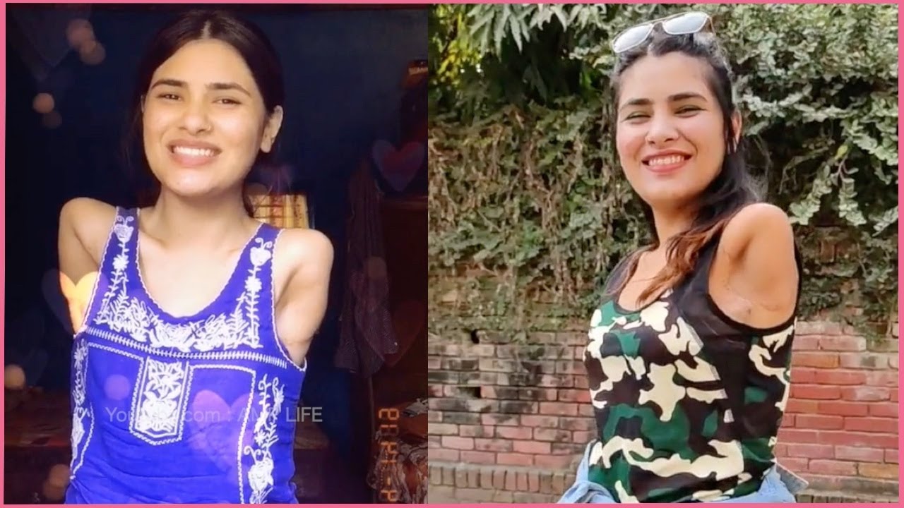 Happiness depends upon ourselves.double shoulder disarticulation amputee