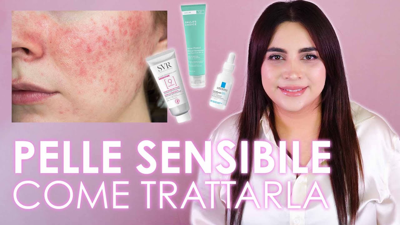 COME TRATTARE LA PELLE SENSIBILE