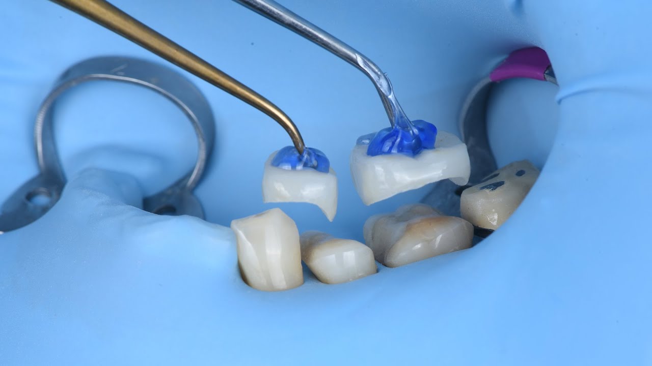 HOW TO OBTAIN PICTURE-PERFECT PHOTOS IN DENTISTRY IN DAILY WORK SCENARIO