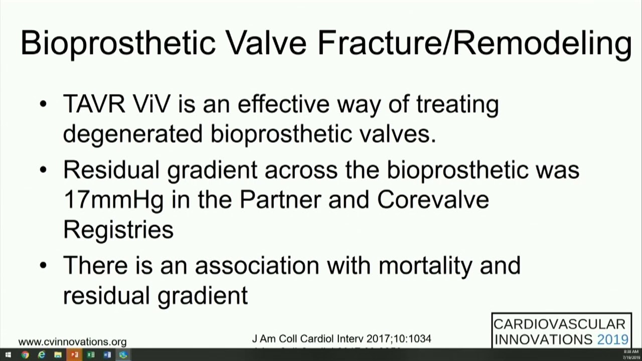 CVI 2019_Friday 7/19_ Innovations in Structural Heart Therapy_Alan Zajarias, MD