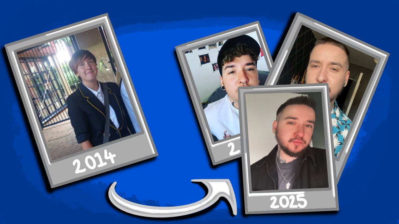 Female To Male 5 Years On Testosterone (Nebido)