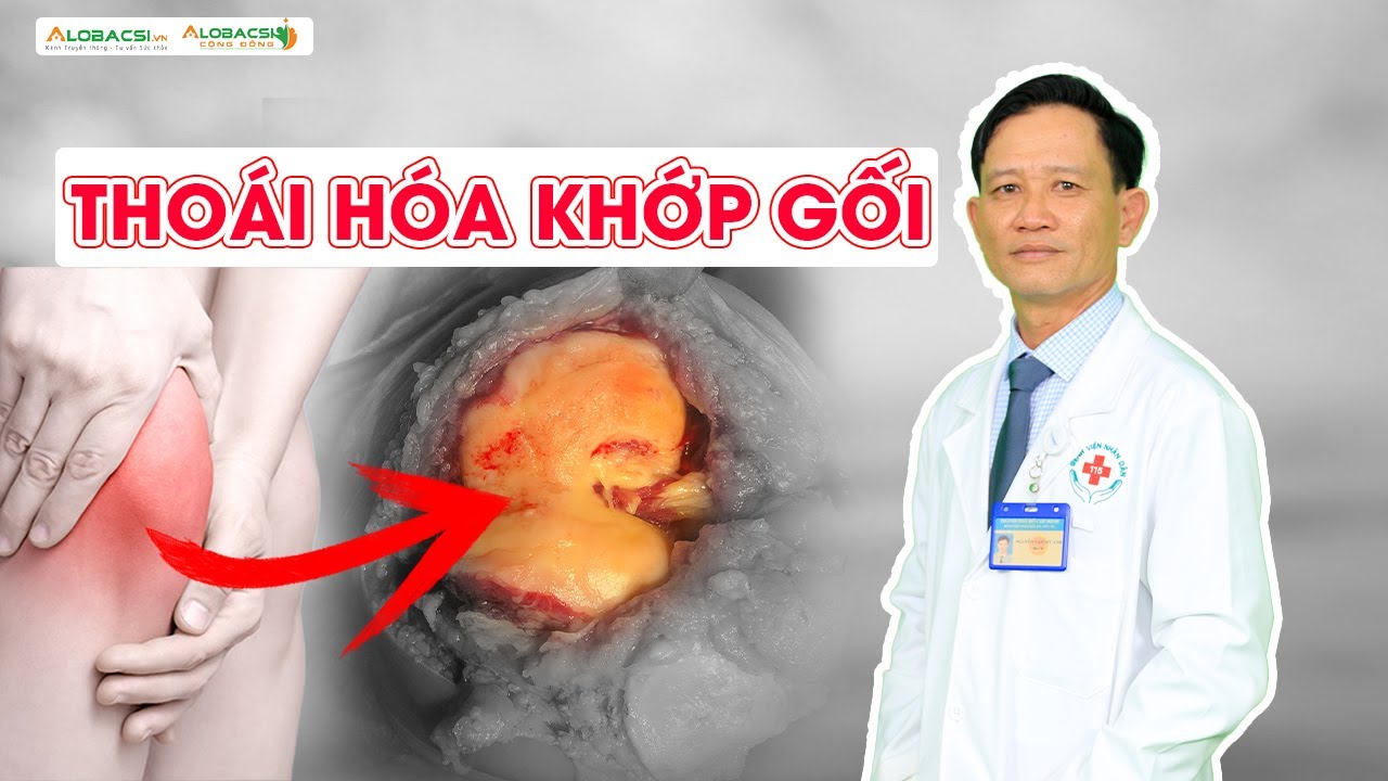 Thoái hóa khớp gối, ngoại khoa giải quyết những vấn đề gì?