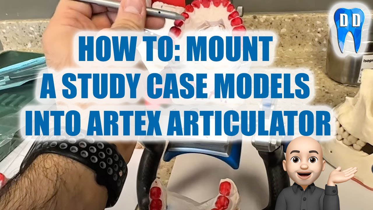 How to mount dental models in articulator (Artex)