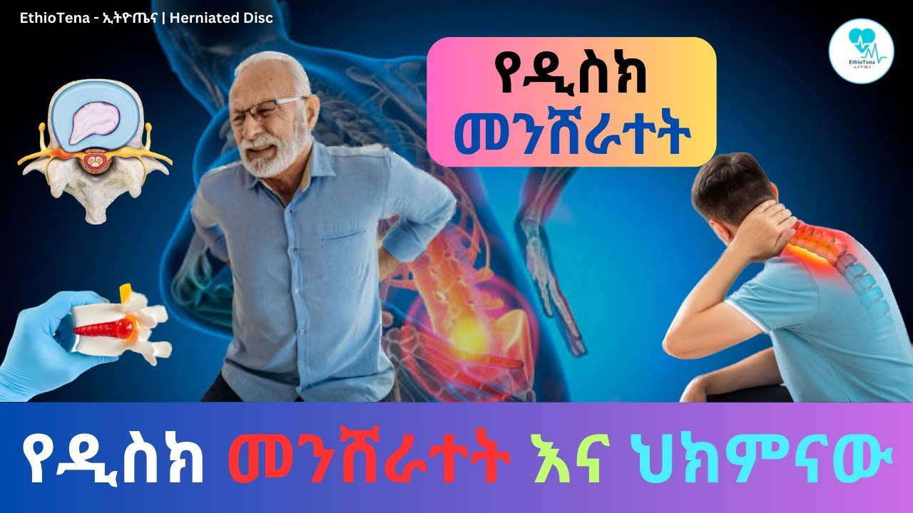 የዲስክ መንሸራተት እና ህክምናው | EthioTena |
