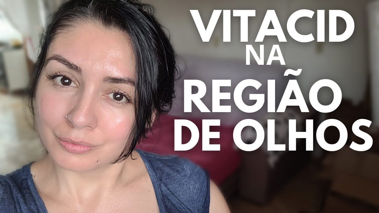 EU USO VITACID 0,05% creme na REGI&Atilde;O DE OLHOS E MOSTREI A APLICA&Ccedil;&Atilde;O