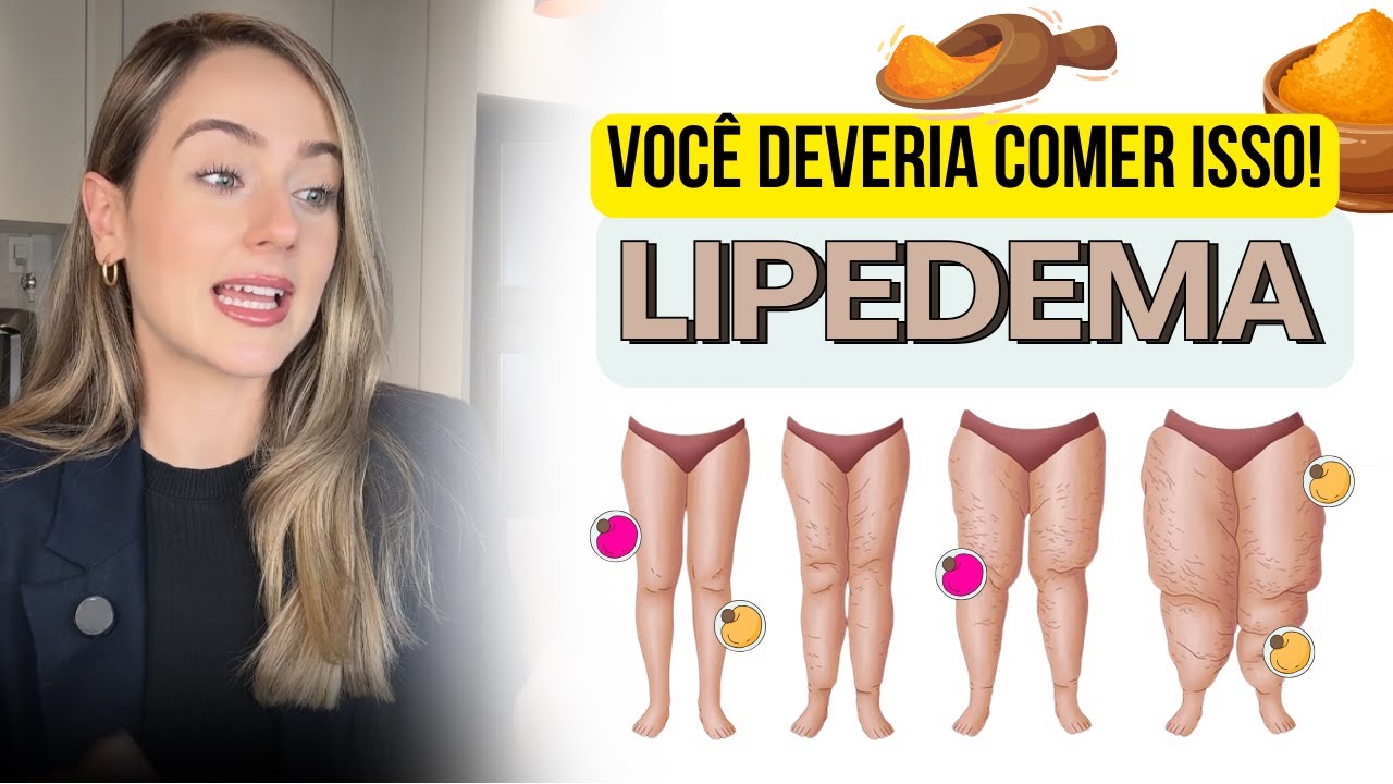 Alimentos Anti-inflamatórios: O Segredo Para Emagrecer e Controlar o Lipedema