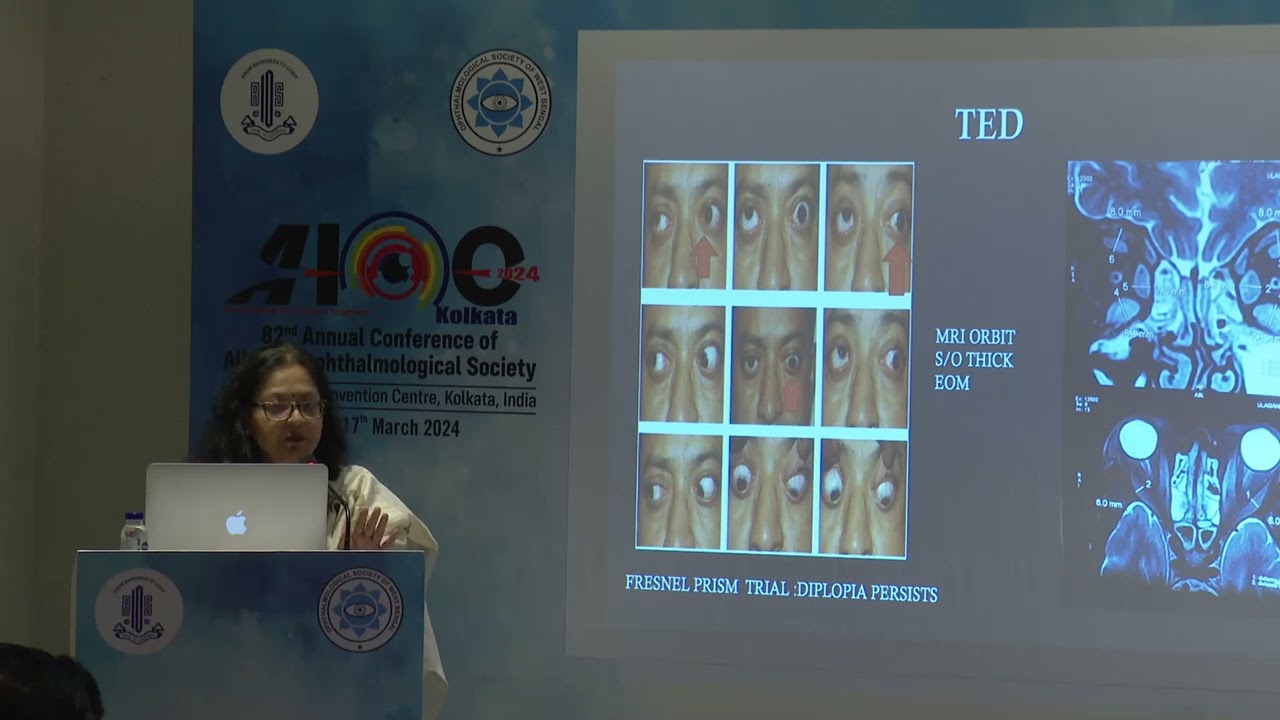 AIOC2024  GP219 Topic  Dr Sujata Guha Improving alignment in vertical strabismus surgery