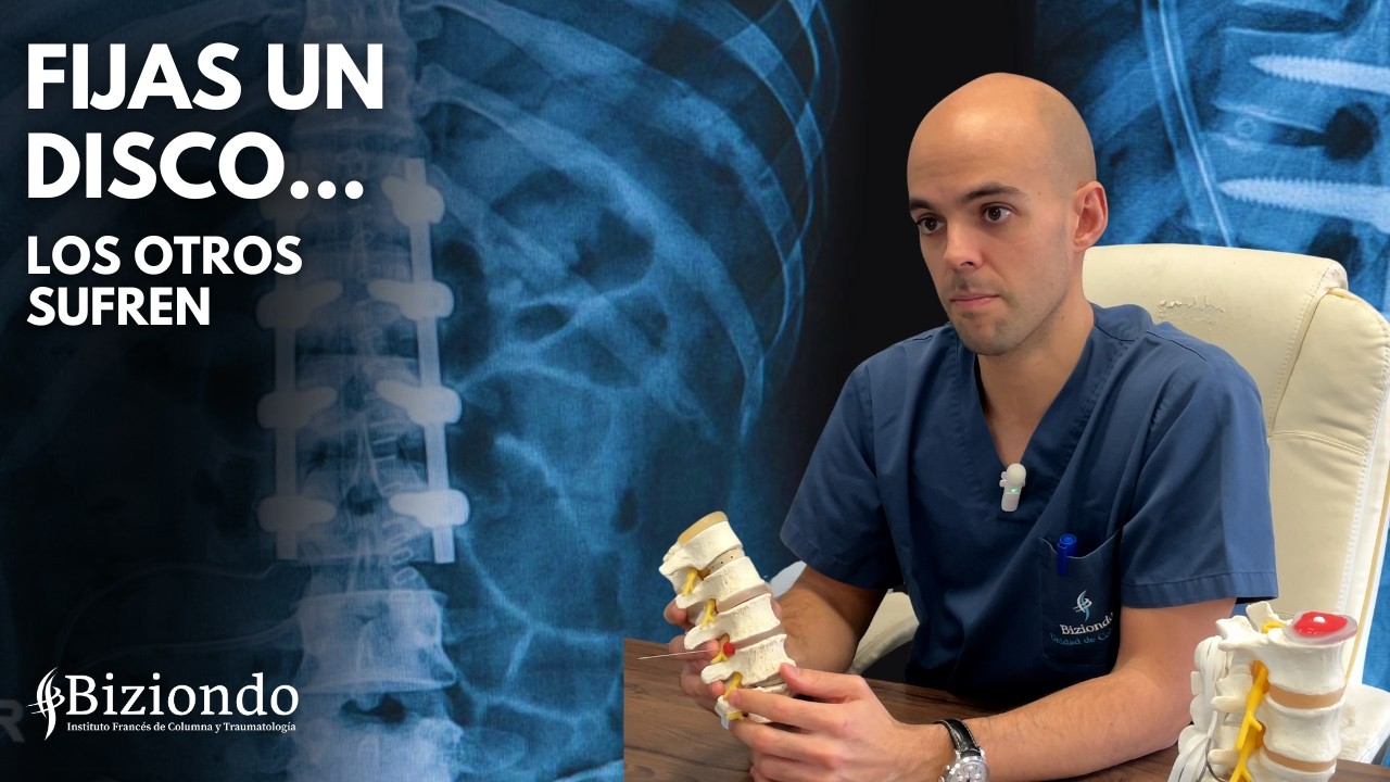 Después de una fusión vertebral: por qué otros discos empiezan a sufrir | Biziondo
