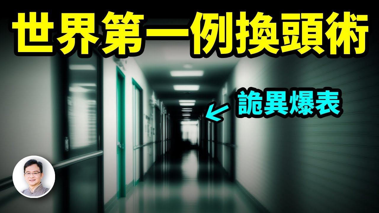 人類首例換頭手術已獲突破；過程中發生了什麼？背後那些驚悚的故事【文昭思緒飛揚353期】