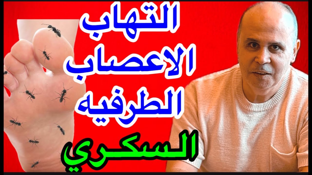 التـــهاب الاعــصاب الطرفيه مع مريض السكر..لا يــنــامNEUROPATHIC PAIN