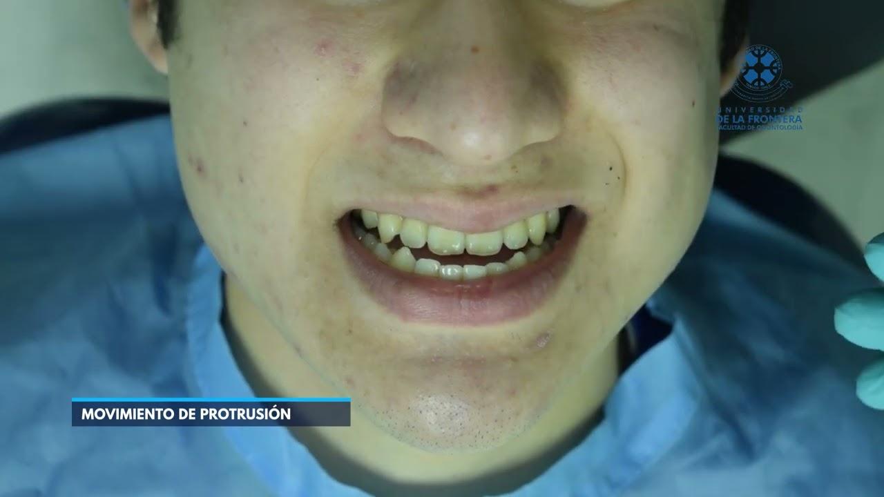 Examen ATM y dinámica mandibular