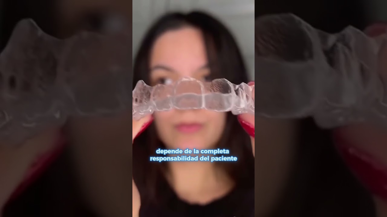 &iquest;Qu&eacute; desventajas de Invisalign? La ortodoncia invisible  #ortodoncia