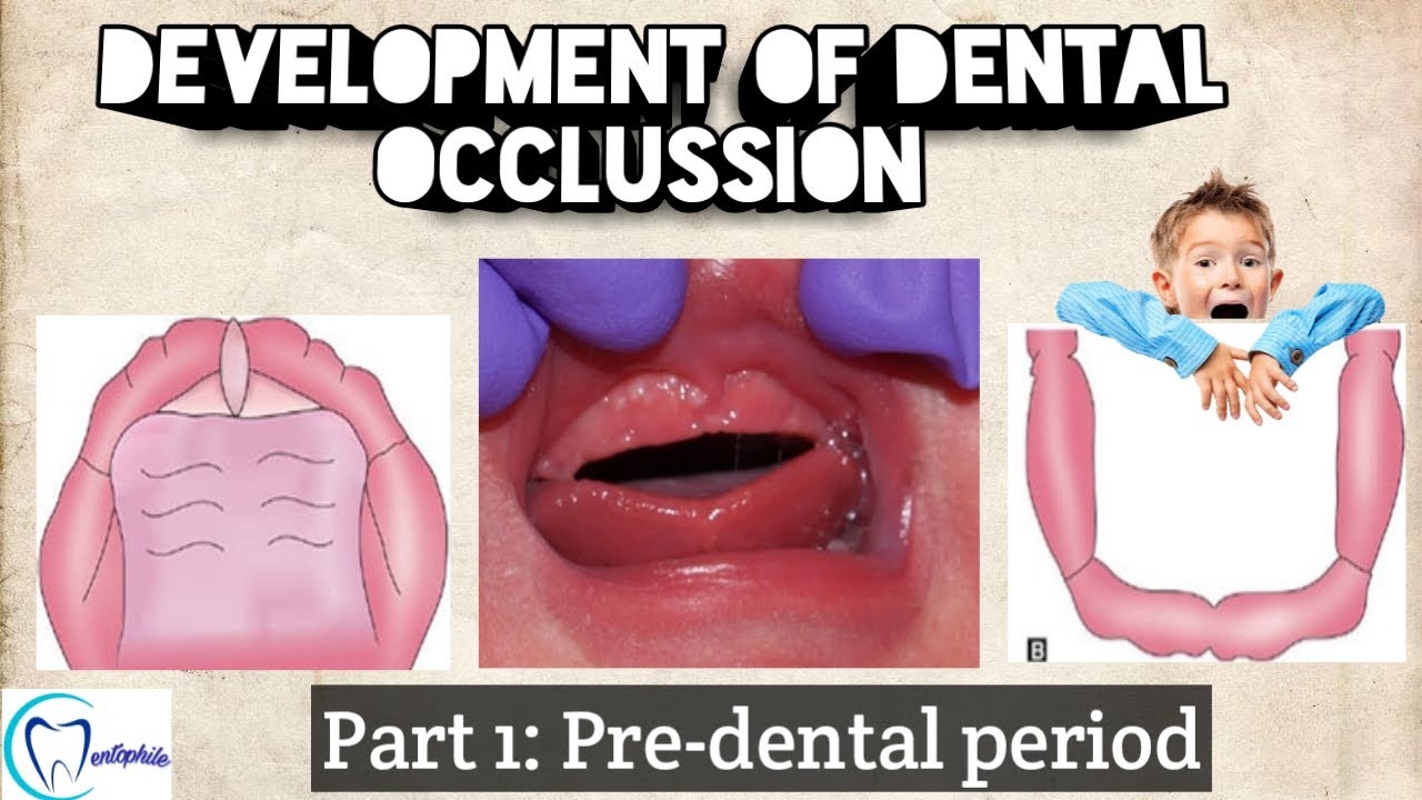 Development of Dental Occlussion || Part 1- Pre-dental period || Pediatric dentistry || Dentophile