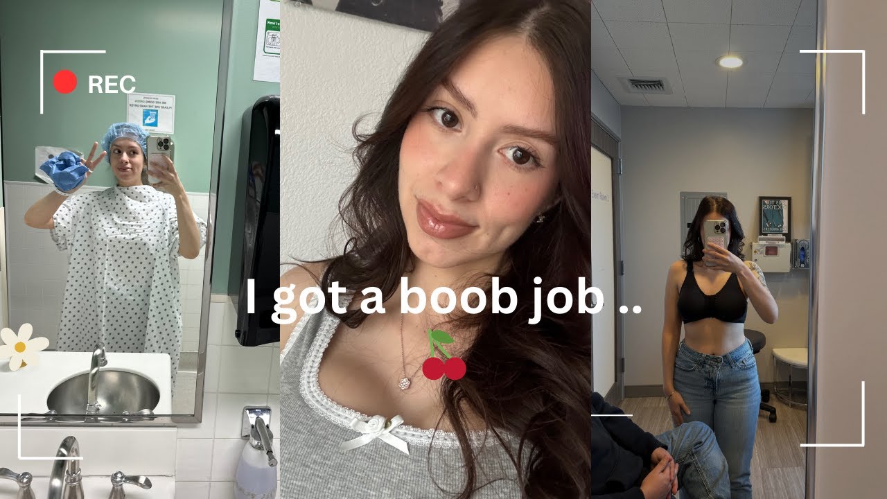 I got a BREAST AUGMENTATION surgery | Vlog | Experience |