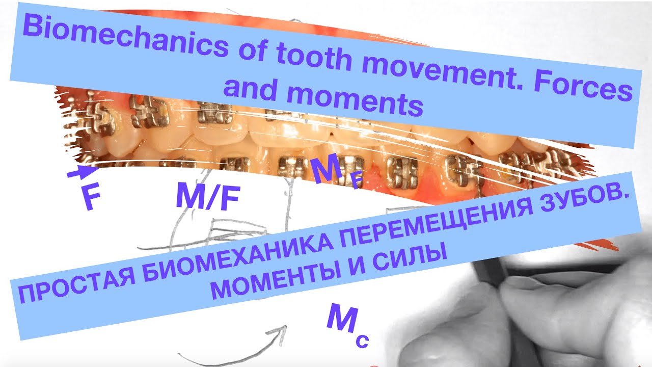 Биомеханика и ортодонтия.Tooth movement biomechanics. Orthodontic tooth movement.