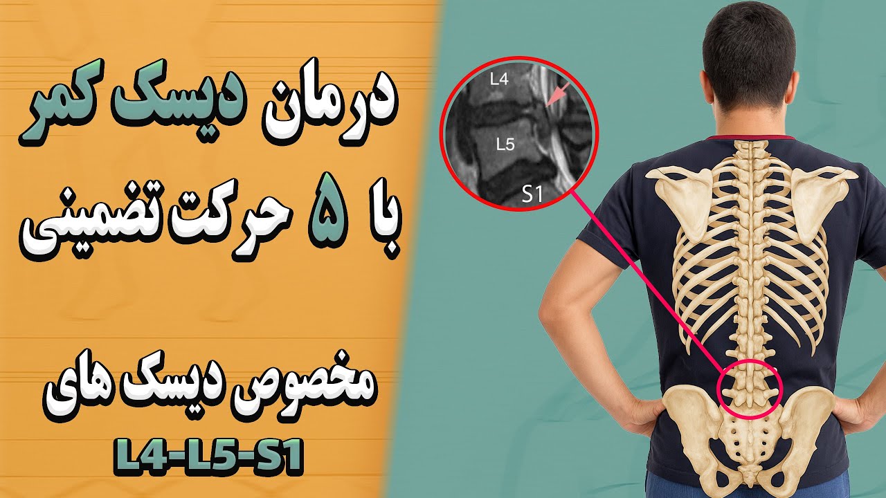 درمان تضمینی دیسک های L4-L5-S1 با 5 حرکت تخصصی در خانه