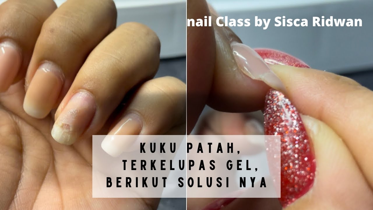 Memperbaiki Kuku Gel yang Patah, Serta Terkelupas. Agar tidak merusak Kuku asli 