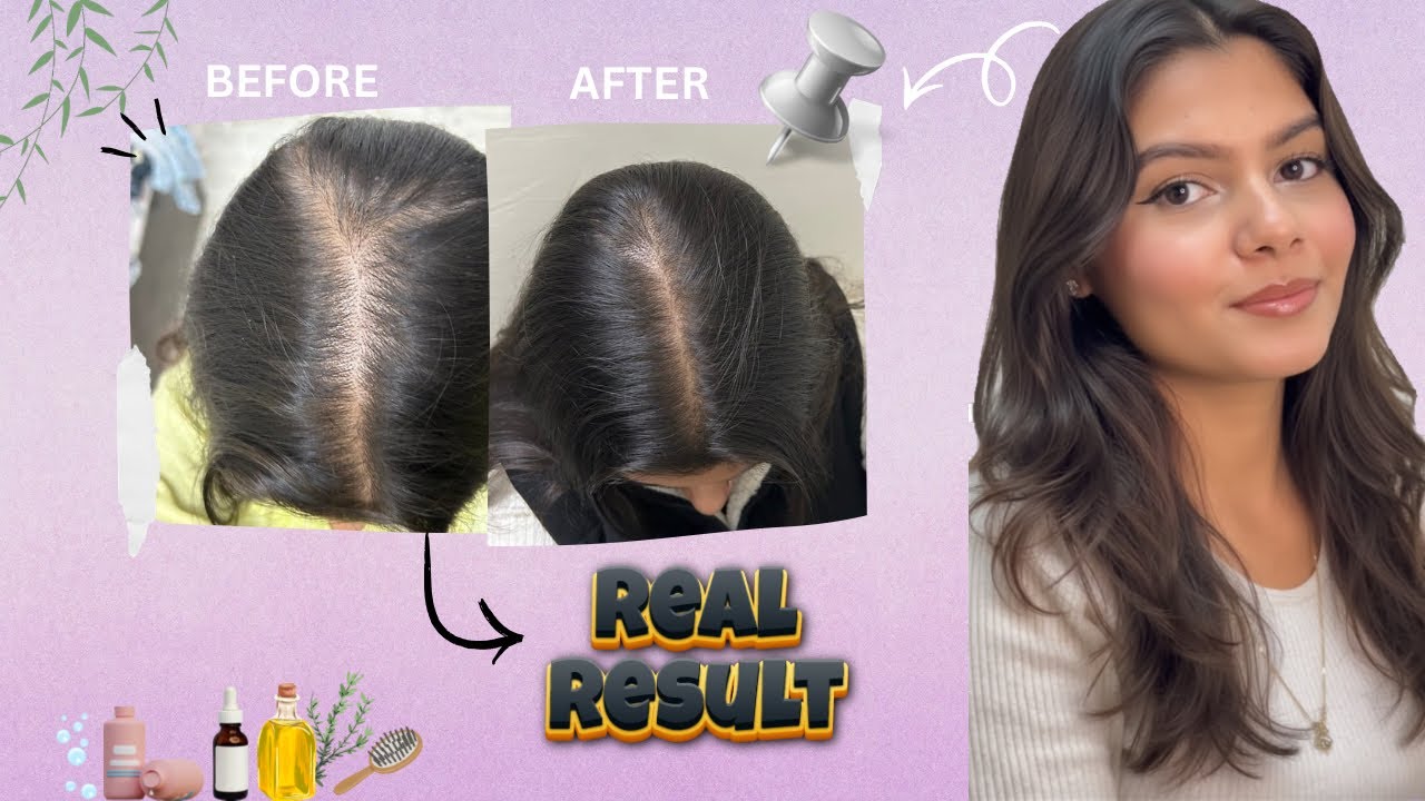 My Hair Transformation 😮Routine | Diet, Products & Consistency