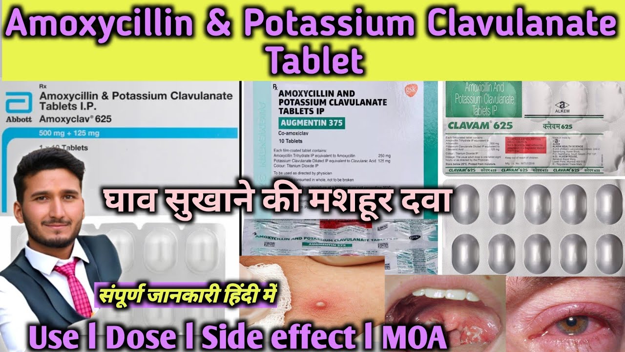 Amoxicillin and potassium clavulanate tablets ip l Amoxyclav Tablet Use Dose Side effects l Warning