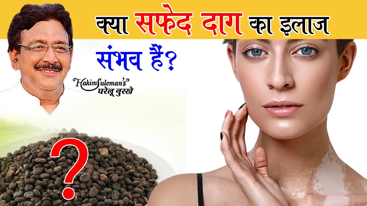 सुंदरता में बाधा बन रहा सफेद दाग, आजमाएं ये बूटी | ABP News