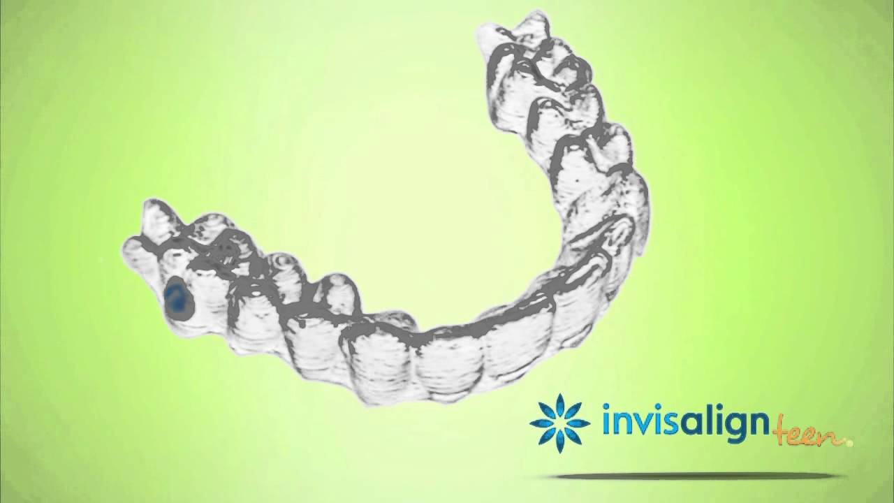 Invisalign Teen - Gainesville's Preferred Provider