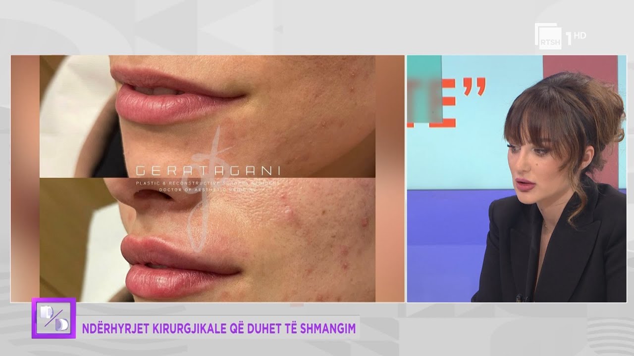 Nd&euml;rhyrjet kirurgjikale q&euml; duhet t&euml; shmangim. Gera Tagani | Dit&euml; pas dite n&euml; RTSH