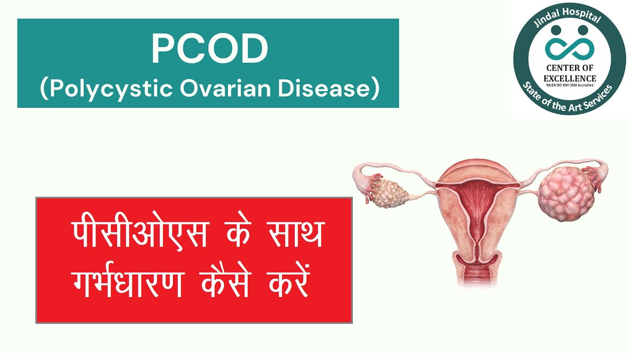 How to get pregnant with PCOS quickly   पीसीओएस के साथ गर्भधारण कैसे करें