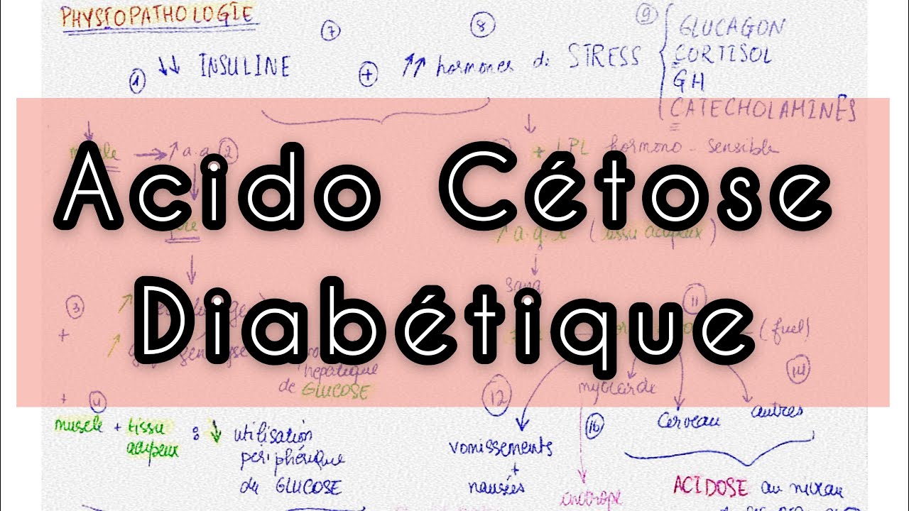 Acido-Cétose Diabétique : Physiopathologie - Resume || Pathologie du Pancréas Endocrine - Médecine