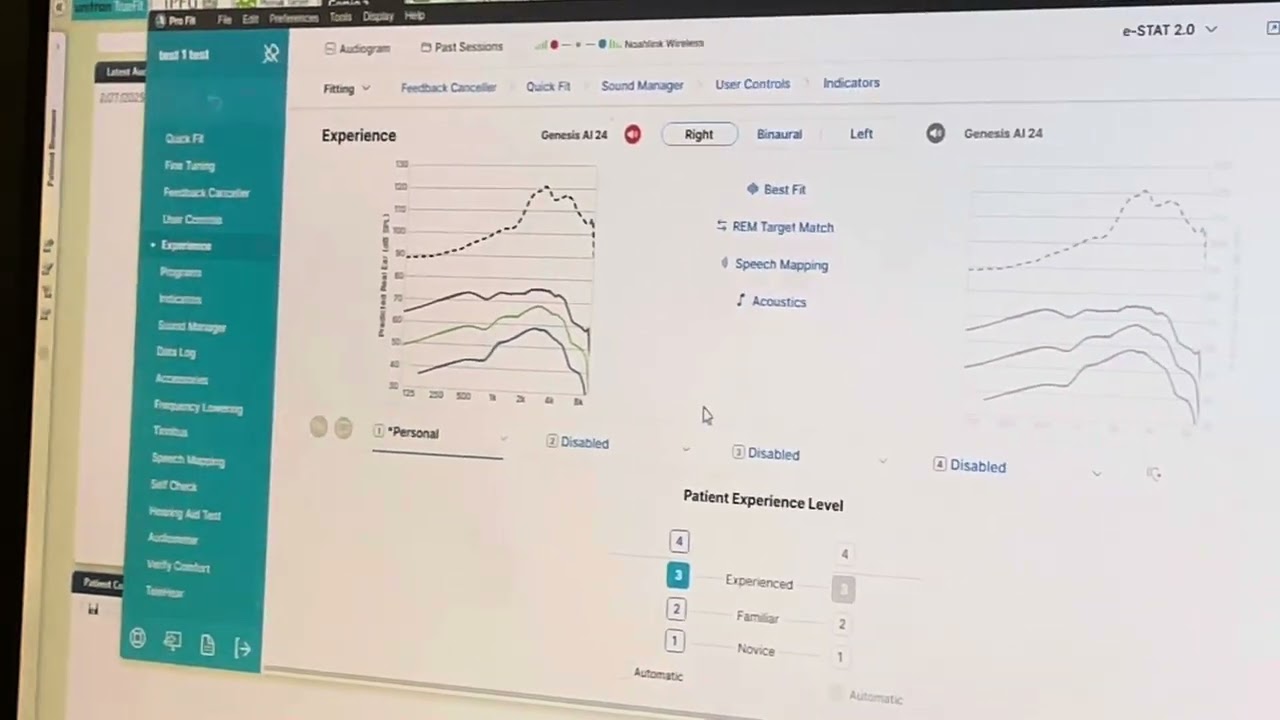 Preprogramming for starkey hearing aids