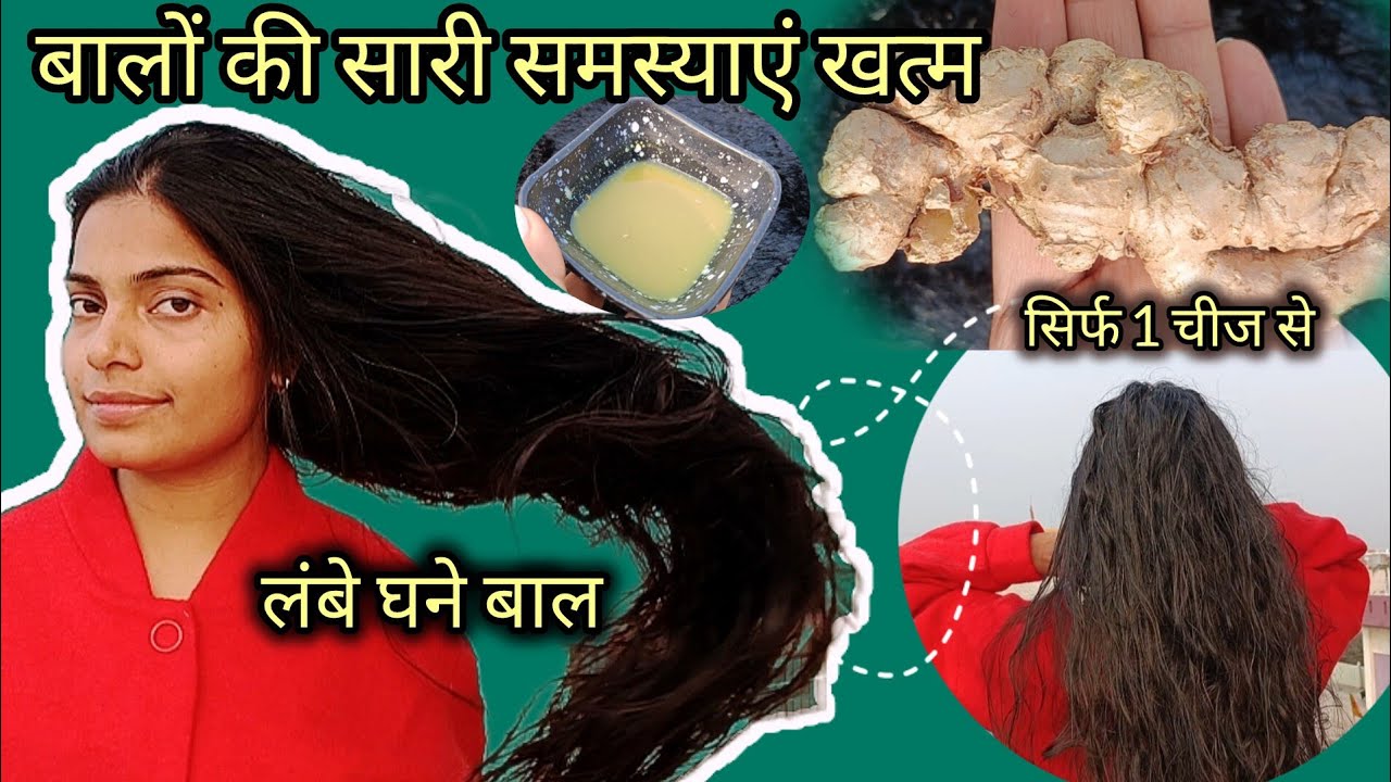Dandruff ka ilaaj bas ek cheez se || How to remove dandruff from your scalp #dishayadav #homeremedy 