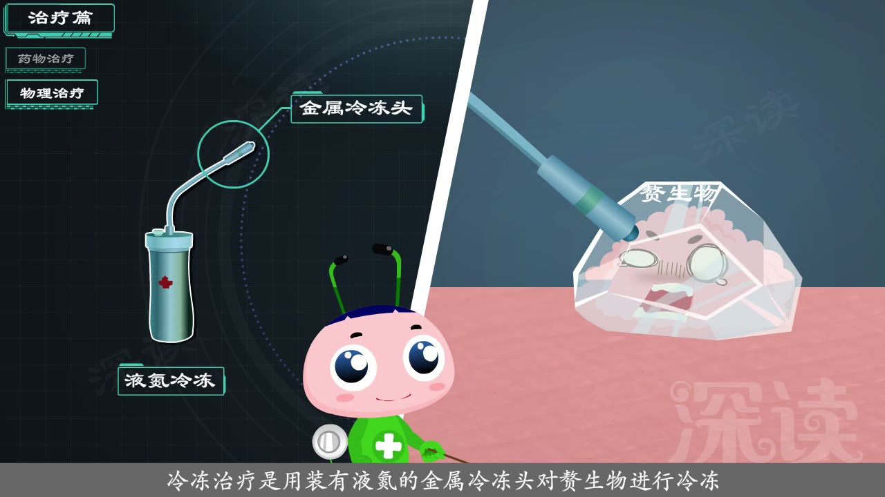 深读-尖锐湿疣4：尖锐湿疣能根治吗？