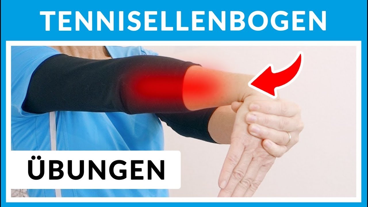 Tennisellenbogen / Tennisarm behandeln ▶ Übungen (Teil 1)