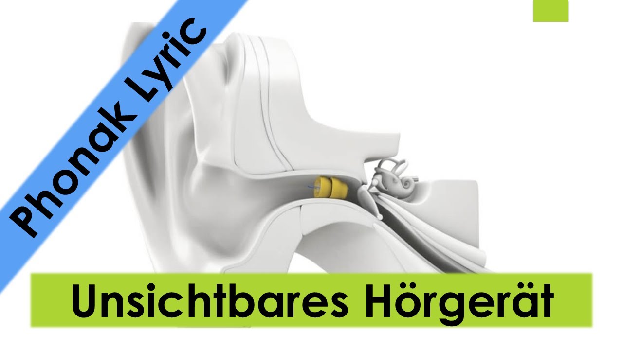 Das kleinste H&ouml;rger&auml;t das niemand sieht: Phonak Lyric - Pietschmann in Frankfurt: So funktioniert es
