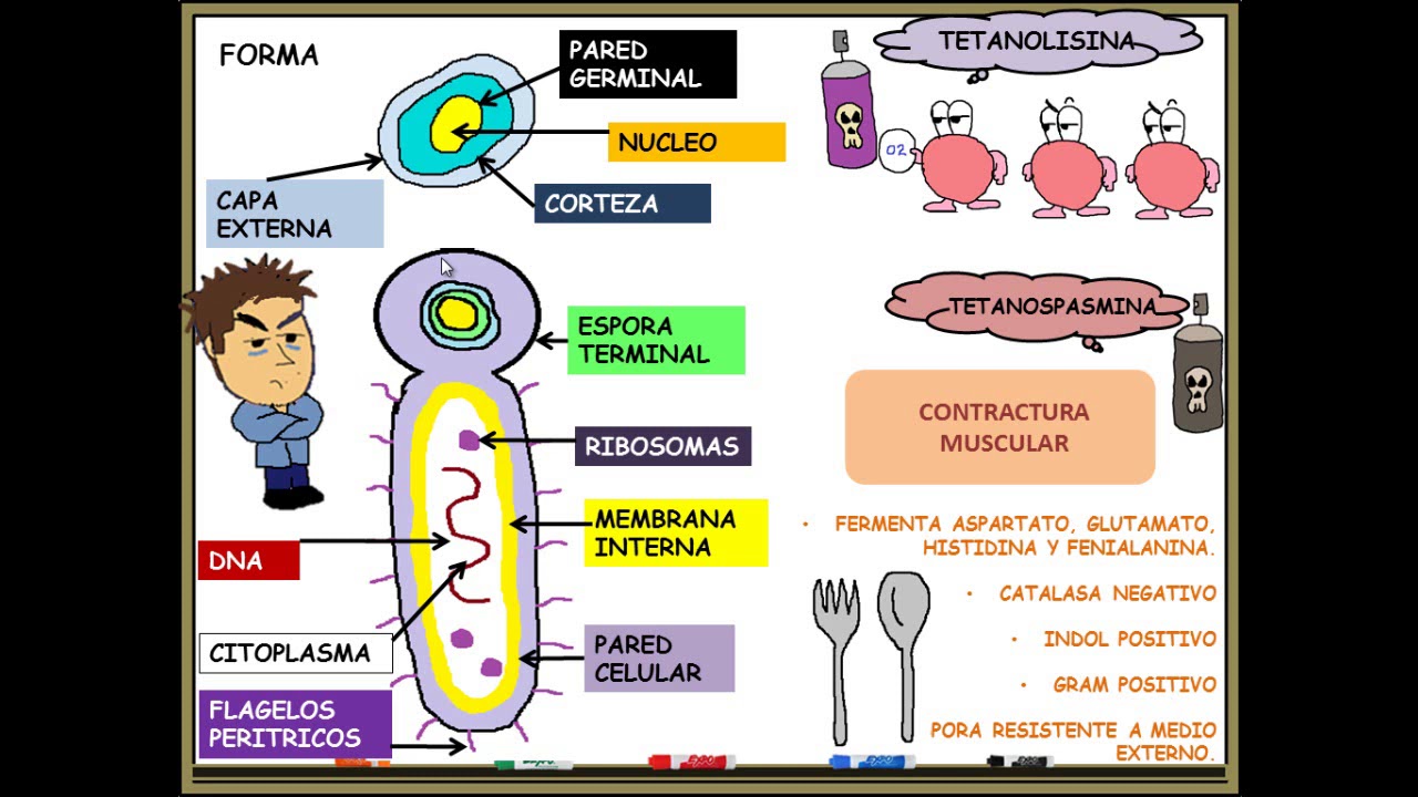 clostridium tetani , tetanos