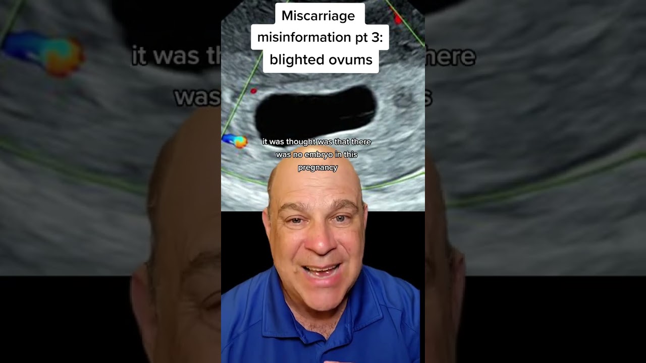 a blighted ovum is an old term for a type of early miscarriage
