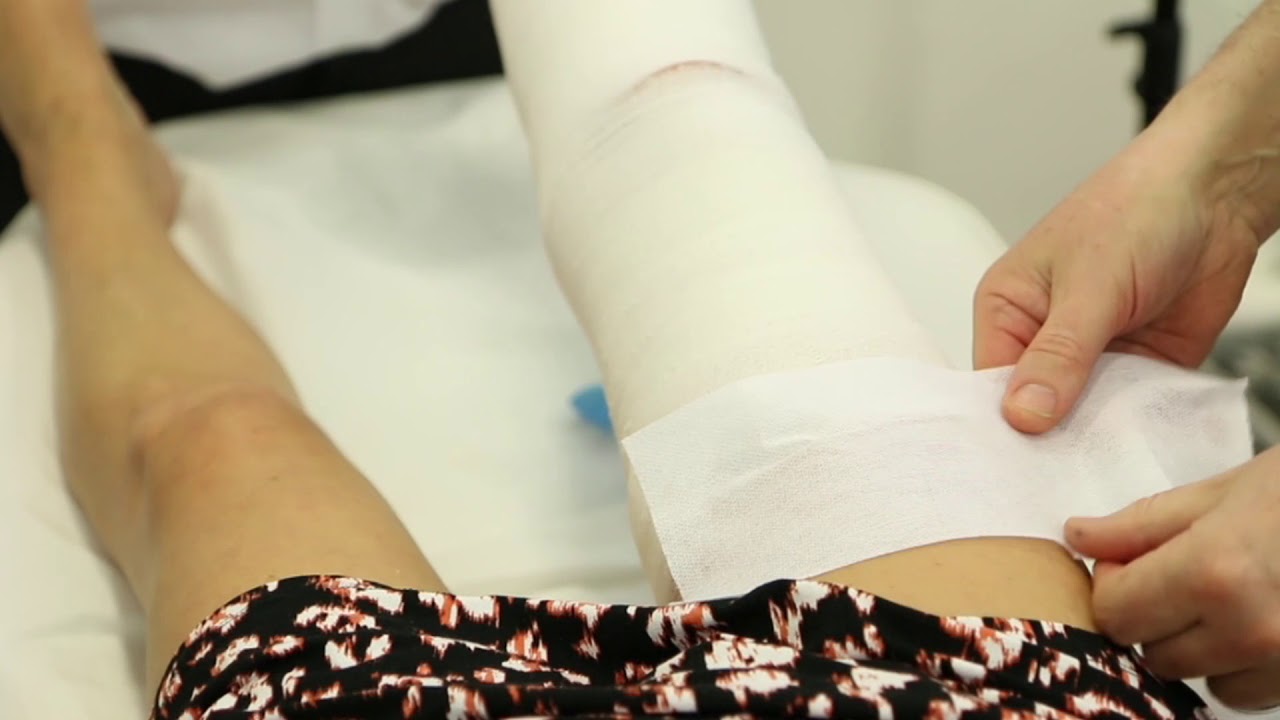 British Association of Sclerotherapists - foam sclerotherapy - Philip Coleridge Smith