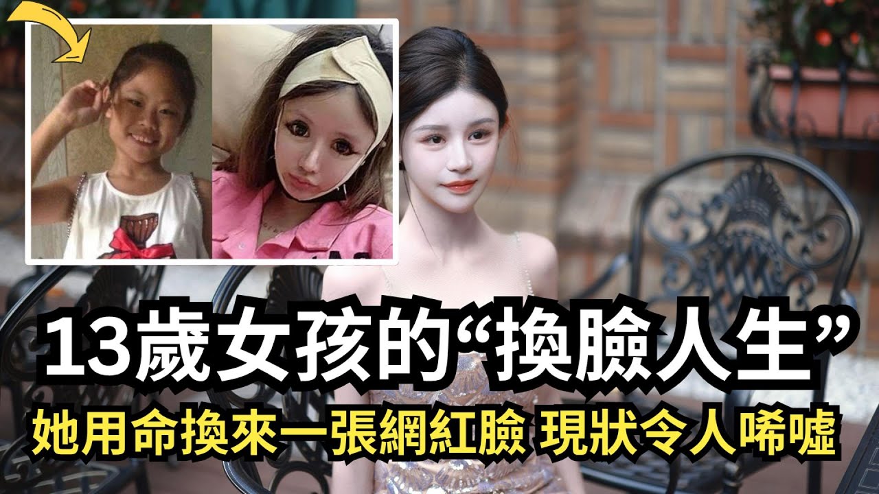 【人物】被罵「黑妹」后，她砸400萬換臉！「超級演說家」 13歲整容少女周楚娜的審美噩夢