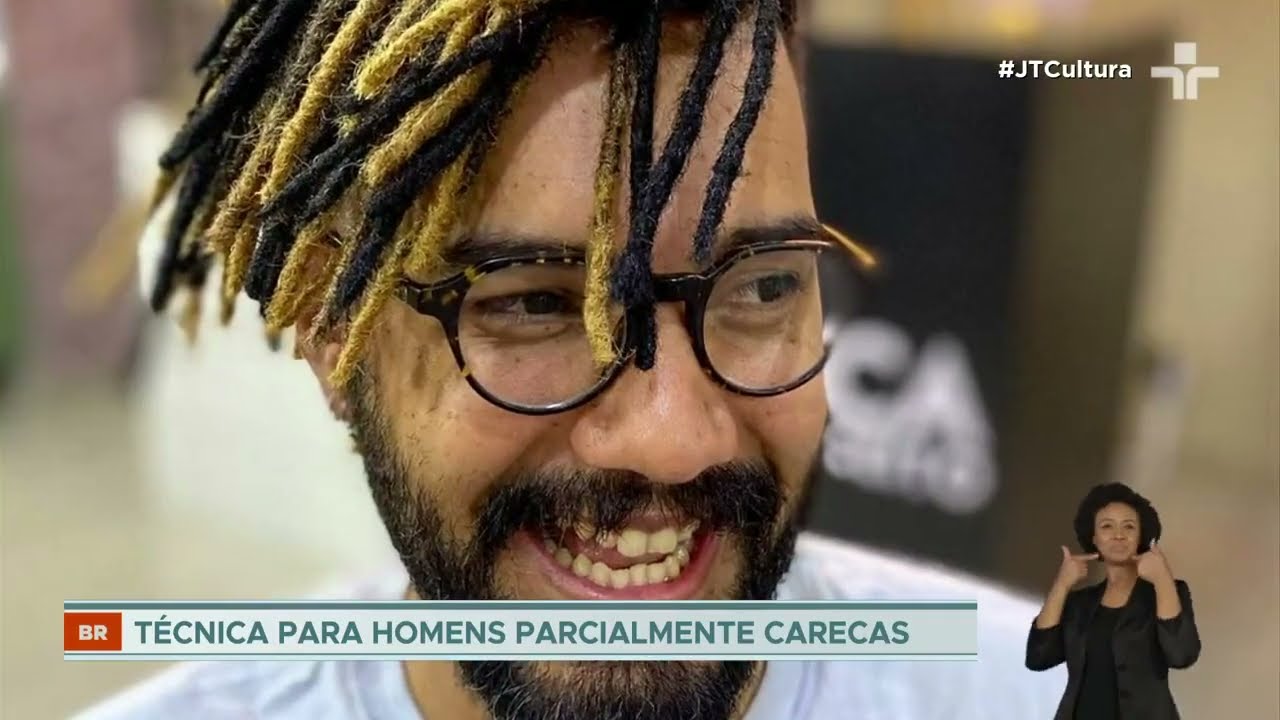 Técnica inédita permite que homens parcialmente carecas possam usar dreadlocks