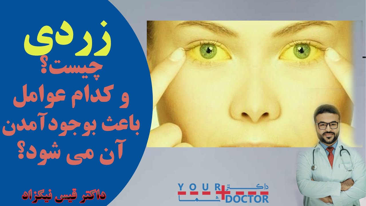 زردی چیست؟ عوامل و درمان آن/Зардпарвин чист? Сабабҳо ва табобати он