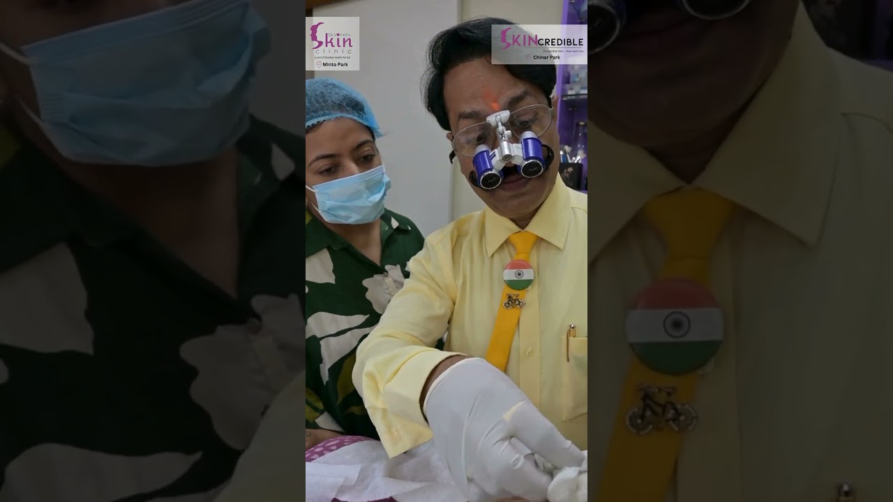Eyebrow Microblading with Dr. Shailvi Bank Biyani I Dr. Vohra's Skin Clinic