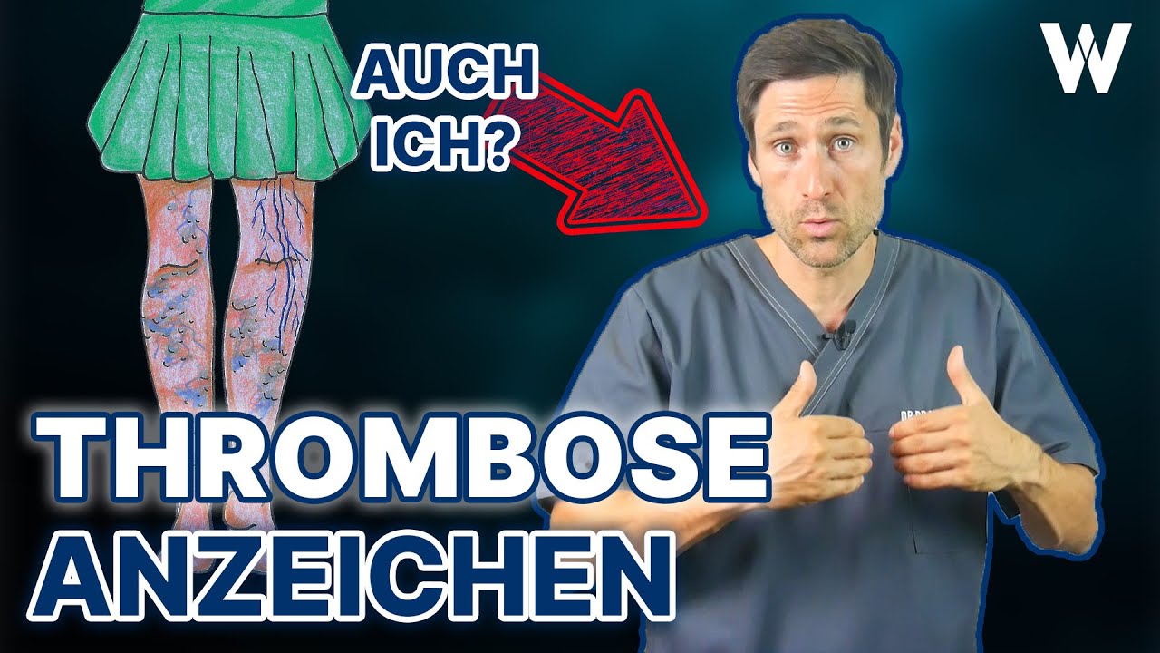 Thrombose: Plötzliche Anzeichen und Lebensgefahr! Typische Auslöser von Sitzen über Pille bis Corona